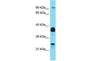 Western Blotting (WB) image for anti-Josephin Domain Containing 1 (JOSD1) (N-Term) antibody (ABIN2490480) (JOSD1 antibody  (N-Term))