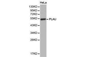 Western Blotting (WB) image for anti-Plasminogen Activator, Urokinase (PLAU) antibody (ABIN1874158) (PLAU antibody)