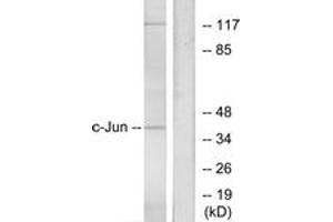 Western Blotting (WB) image for anti-Jun Proto-Oncogene (JUN) (AA 40-89) antibody (ABIN2888966) (C-JUN antibody  (AA 40-89))