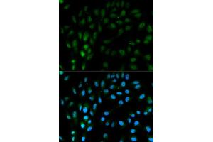 Immunofluorescence analysis of MCF7 cell using TFPI antibody. (TFPI antibody)