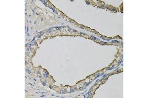 Immunohistochemistry of paraffin-embedded human prostate using LCN1 antibody (ABIN6003560) at dilution of 1/100 (40x lens). (Lipocalin 1 antibody)