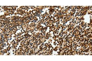 Immunohistochemistry of paraffin-embedded Human tonsil using SOX-13 Polyclonal Antibody at dilution of 1:50 (SOX13 antibody)