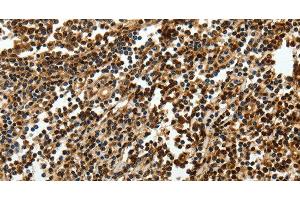 Immunohistochemistry of paraffin-embedded Human tonsil using SOX-13 Polyclonal Antibody at dilution of 1:50