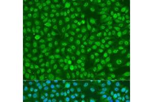 Immunofluorescence analysis of U2OS cells using Phospho-BRCA1(S1423) Polyclonal Antibody at dilution of 1:100.