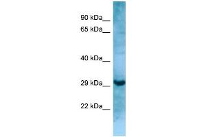 WB Suggested Anti-MASP1 Antibody Titration: 1. (MASP1 antibody  (N-Term))