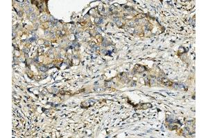 IHC analysis of Ribonuclease Inhibitor/RNH1 using anti-Ribonuclease Inhibitor/RNH1 antibody (ABIN7603117).