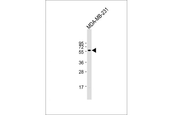 ONECUT3 anticorps  (C-Term)