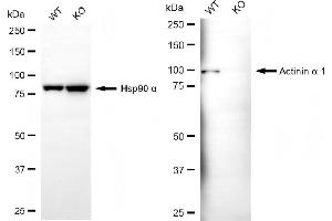 Western blotting analysis using actinin alpha 1 antibody (ABIN7797471).