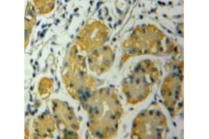 Used in DAB staining on fromalin fixed paraffin-embedded Stomach tissue (CSNK1A1 antibody  (AA 130-337))
