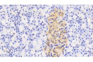 Immunohistochemistry (IHC) image for anti-N-Acetylgalactosaminidase, alpha (NAGA) (AA 18-217) antibody (ABIN7436486)