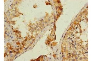 Immunohistochemistry of paraffin-embedded human testis tissue using ABIN7161917 at dilution of 1:100 (NRBP1 antibody  (AA 406-535))