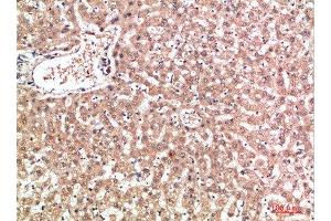Immunohistochemical analysis of paraffin-embedded human-liver, antibody was diluted at 1:200 (EPG5 antibody  (AA 141-190))