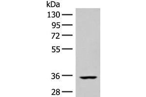 Western blot analysis of Human heart tissue lysate using FBXO16 Polyclonal Antibody at dilution of 1:400