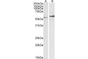 ABIN2613493 (0. (Vimentin antibody  (C-Term))