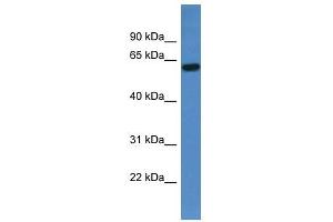 Western Blot showing TCHP antibody used at a concentration of 1-2 ug/ml to detect its target protein. (TCHP antibody  (C-Term))