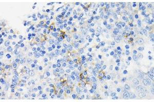 Immunohistochemistry of paraffin-embedded Human tonsil using CAMP Polyclonal Antibody at dilution of 1:200 (40x lens). (Cathelicidin antibody)