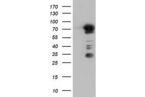 HEK293T cells were transfected with the pCMV6-ENTRY control (Left lane) or pCMV6-ENTRY ARHGAP25 (Right lane) cDNA for 48 hrs and lysed. (ARHGAP25 antibody)