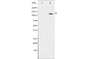 Western blot analysis of Retinoblastoma phosphorylation expression in serum treated K562 whole cell lysates,The lane on the left is treated with the antigen-specific peptide. (Retinoblastoma 1 antibody  (pSer780))