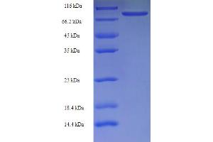 RNA Binding Motif Protein, Y-Linked, Family 1, Member F (RBMY1F) (AA 1-496), (full length) protein (His-SUMO Tag)