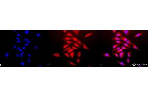 Immunocytochemistry/Immunofluorescence analysis using Rabbit Anti-SOD (Cu/Zn) Polyclonal Antibody . (SOD1 antibody  (PerCP))