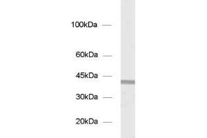 dilution: 1 : 1000, sample: P2 of rat pancreas (Syntaxin 18 antibody  (AA 55-313))