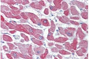 Heart, Human: Formalin-Fixed, Paraffin-Embedded (FFPE) (CRYAB antibody)