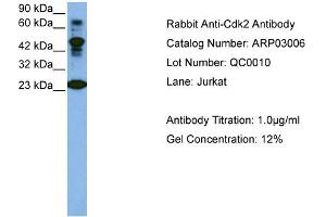 Western Blotting (WB) image for anti-Cyclin-Dependent Kinase 2 (CDK2) (C-Term) antibody (ABIN184162) (CDK2 antibody  (C-Term))