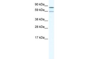 Western Blotting (WB) image for anti-Poly A Specific Ribonuclease (PARN) antibody (ABIN2461521) (PARN antibody)
