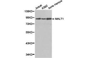 Western Blotting (WB) image for anti-Mucosa Associated Lymphoid Tissue Lymphoma Translocation Gene 1 (MALT1) antibody (ABIN1873591) (MALT1 antibody)