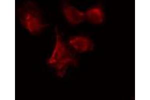 ABIN6274085 staining Hela cells by IF/ICC. (CDC7 antibody  (N-Term))