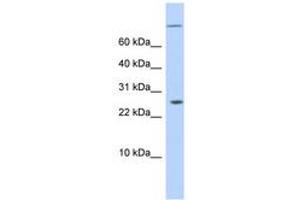 Image no. 1 for anti-AT Rich Interactive Domain 5A (MRF1-Like) (ARID5A) (N-Term) antibody (ABIN6743583) (ARID5A antibody  (N-Term))