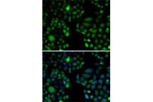 Immunofluorescence analysis of U2OS cells using EPC1 antibody (ABIN6133506, ABIN6140203, ABIN6140204 and ABIN6221494).