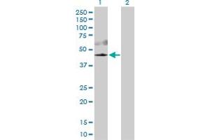 Western Blot analysis of AKT3 expression in transfected 293T cell line by AKT3 MaxPab polyclonal antibody. (AKT3 antibody  (AA 1-479))