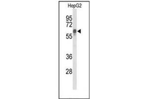 Western blot analysis of ITPKC Antibody (N-term) in HepG2 cell line lysates (35ug/lane). (ITPKC antibody  (N-Term))