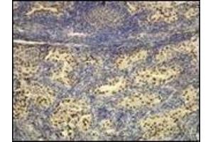 Immunohistochemistry (IHC) image for anti-Transcription Termination Factor, RNA Polymerase I (TTF1) (N-Term) antibody (ABIN870524) (TTF1 antibody  (N-Term))