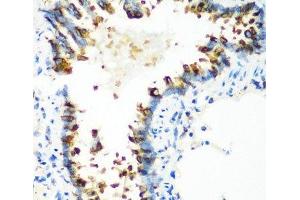 Immunohistochemistry of paraffin-embedded Rat lung using MTCO2 Polyclonal Antibody at dilution of 1:100 (40x lens). (COX2 antibody)