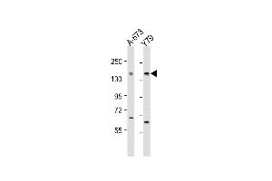 All lanes : Anti-CACNA1F Antibody (Center) at 1:2000 dilution Lane 1: A-673 whole cell lysate Lane 2: Y79 whole cell lysate Lysates/proteins at 20 μg per lane. (CACNA1F antibody  (AA 743-776))