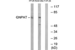 Western Blotting (WB) image for anti-Glyceronephosphate O-Acyltransferase (GNPAT) (AA 231-280) antibody (ABIN2890262)