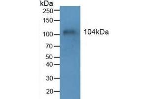 Detection of MUC1 in Human Blood Cells using Polyclonal Antibody to Mucin 1 (MUC1) (MUC1 antibody  (AA 1034-1151))