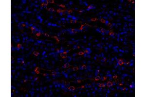 Immunohistochemistry (IHC) image for anti-Early Endosome Antigen 1 (EEA1) (AA 2-13) antibody (ABIN1742484) (EEA1 antibody  (AA 2-13))