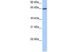 WB Suggested Anti-ZNF449 Antibody Titration:  0.