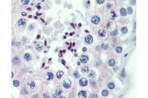 Anti-PRDM9 antibody IHC staining of human testis.