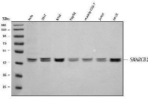 Western blot analysis of SNF5/SMARCB1 using anti-SNF5/SMARCB1 antibody (ABIN7599663).