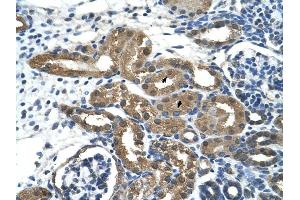 HDAC9 antibody was used for immunohistochemistry at a concentration of 2. (HDAC9 antibody  (C-Term))