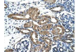 HDAC9 antibody was used for immunohistochemistry at a concentration of 2.