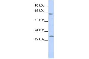 WB Suggested Anti-SLC18A1 Antibody Titration:  0. (SLC18A1 antibody  (Middle Region))