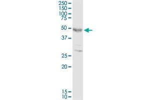 FOXP3 MaxPab rabbit polyclonal antibody. (FOXP3 antibody  (AA 1-431))