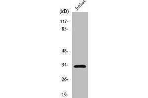 Western Blot analysis of Jurkat cells using Cleaved-Cathepsin A 32k (R326) Polyclonal Antibody (CTSA antibody  (Cleaved-Arg326))