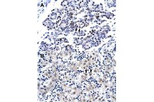 Immunohistochemical staining (Formalin-fixed paraffin-embedded sections) of human pancreas (A) and human liver (B) with CDX4 polyclonal antibody  at 4-8 ug/mL working concentration. (CDX4 antibody  (C-Term))