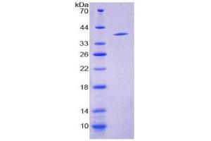 SDS-PAGE (SDS) image for Neuropeptide S (NPS) (AA 29-88) protein (His tag,GST tag) (ABIN2123385)